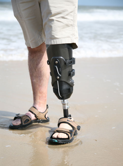 Man with prosthetic leg at the beach